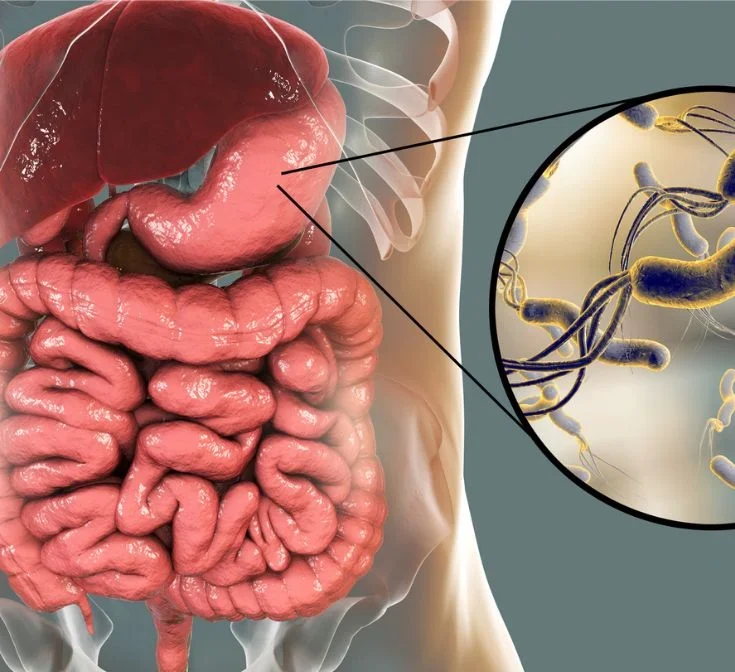 H Pylori Bacteria Signs Symptoms How To Get Rid Of It Naturally