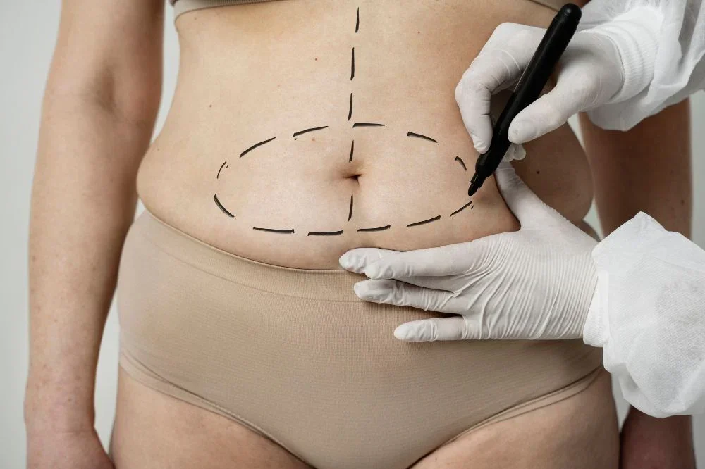 Cirugias Corporales Esteticas
